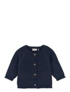Cardigan Knit Fixoni Navy